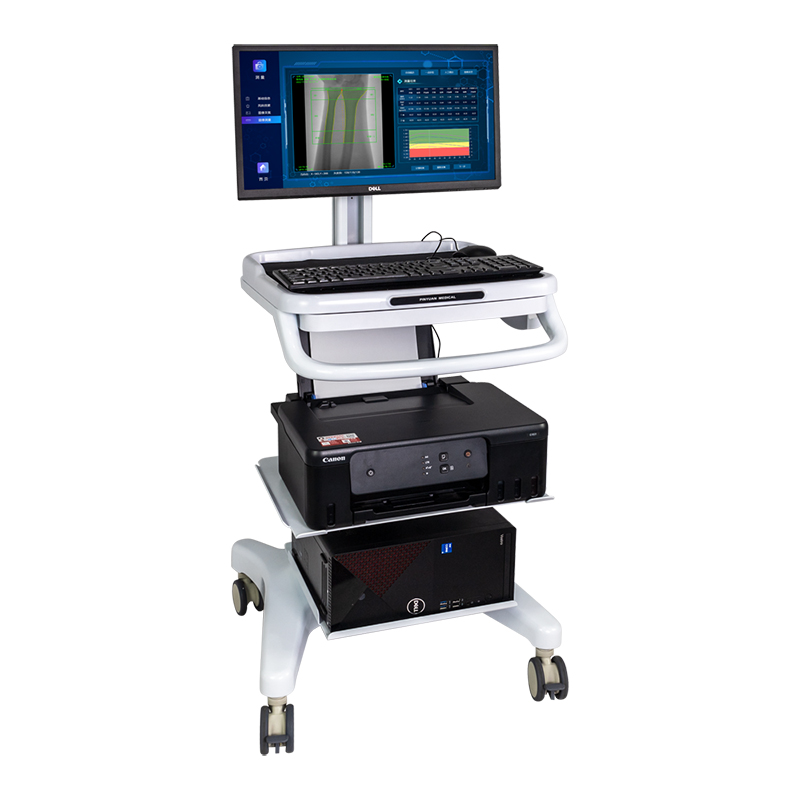 雙能X線骨密度儀